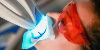 Teeth Whitening