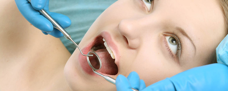 Aesthetic Dental Fillings