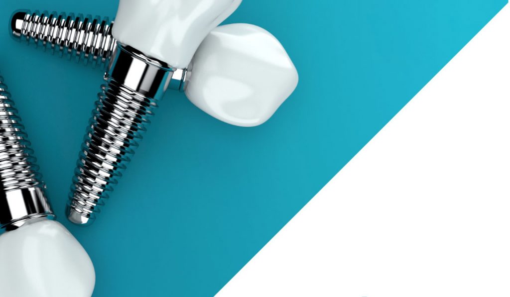 Implant Tooth Making