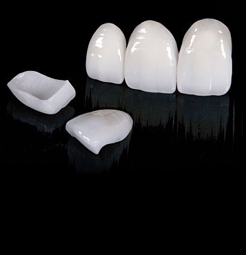 Zirconium and Ceramic Teeth
